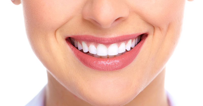 10 kinh nghiệm tẩy trắng răng hiệu quả không ảnh hưởng tới sức khỏe