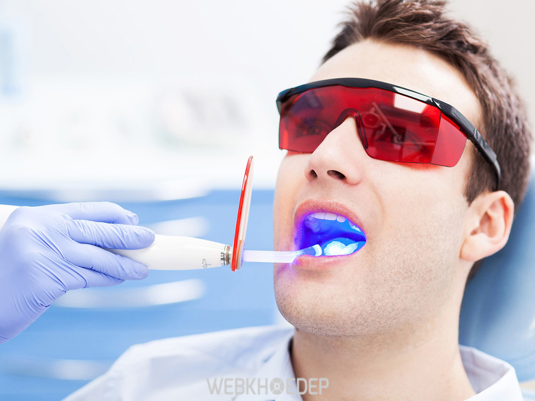 Tẩy trắng răng tại cơ sở nha khoa được coi là phương pháp tối ưu nhất 