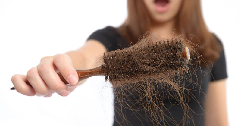 20 nguyên nhân tóc rụng nhiều ở nam lẫn nữ và cách khắc phục