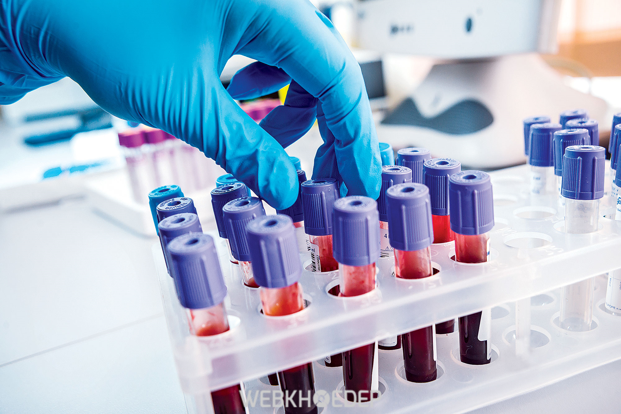 Bên cạnh thực hiện xét nghiệm gen, tại Vinmec bạn sẽ còn được kiểm tra chéo kết quả với công nghệ tiên tiến nhằm đảm bảo độ chính xác cao 