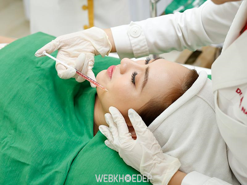 Tiêm filler là phương pháp nâng mũi không phẫu thuật phổ biến hiện nay
