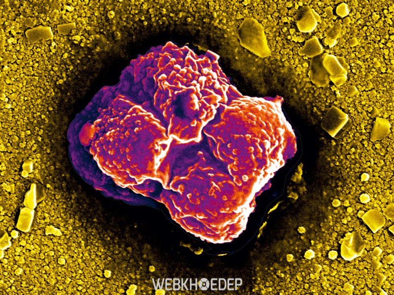 Các tế bào bạch cầu đang xâm chiếm trong máu