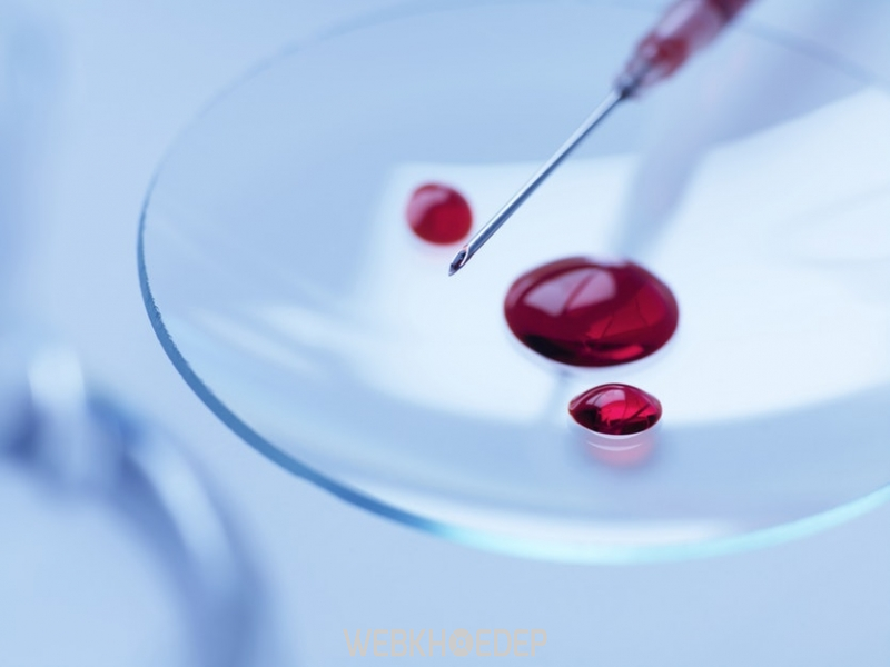 Phương pháp xét nghiệm ung thư máu bằng sinh thiết 