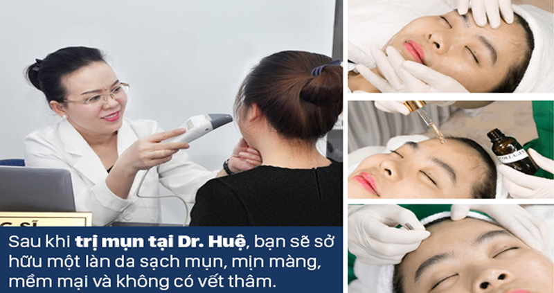 Bị mụn mọc ở hai bên thái dương là bệnh gì, nguyên nhân và cách trị