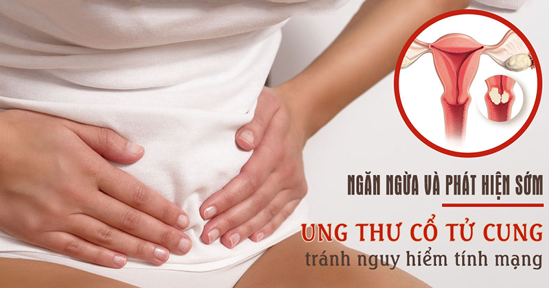 Khám sàng lọc ung thư cổ tử cung