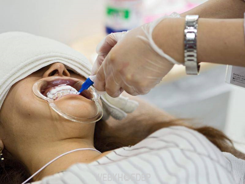 Liệu tẩy trắng răng có gây hại hay ảnh hưởng gì đến sức khỏe răng miệng hay không vẫn là câu hỏi được rất nhiều người quan tâm 