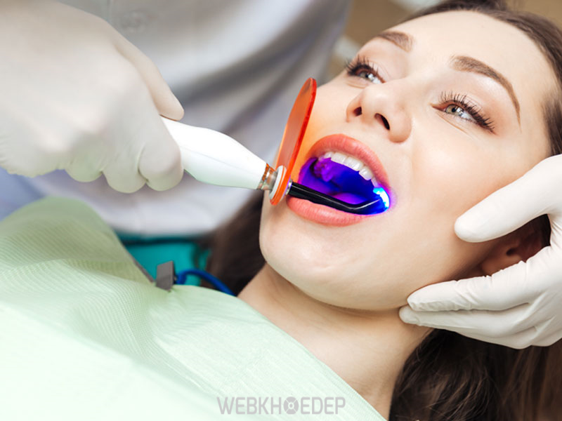Lựa chọn phương pháp tẩy răng phù hợp với túi tiền cũng như tình trạng răng