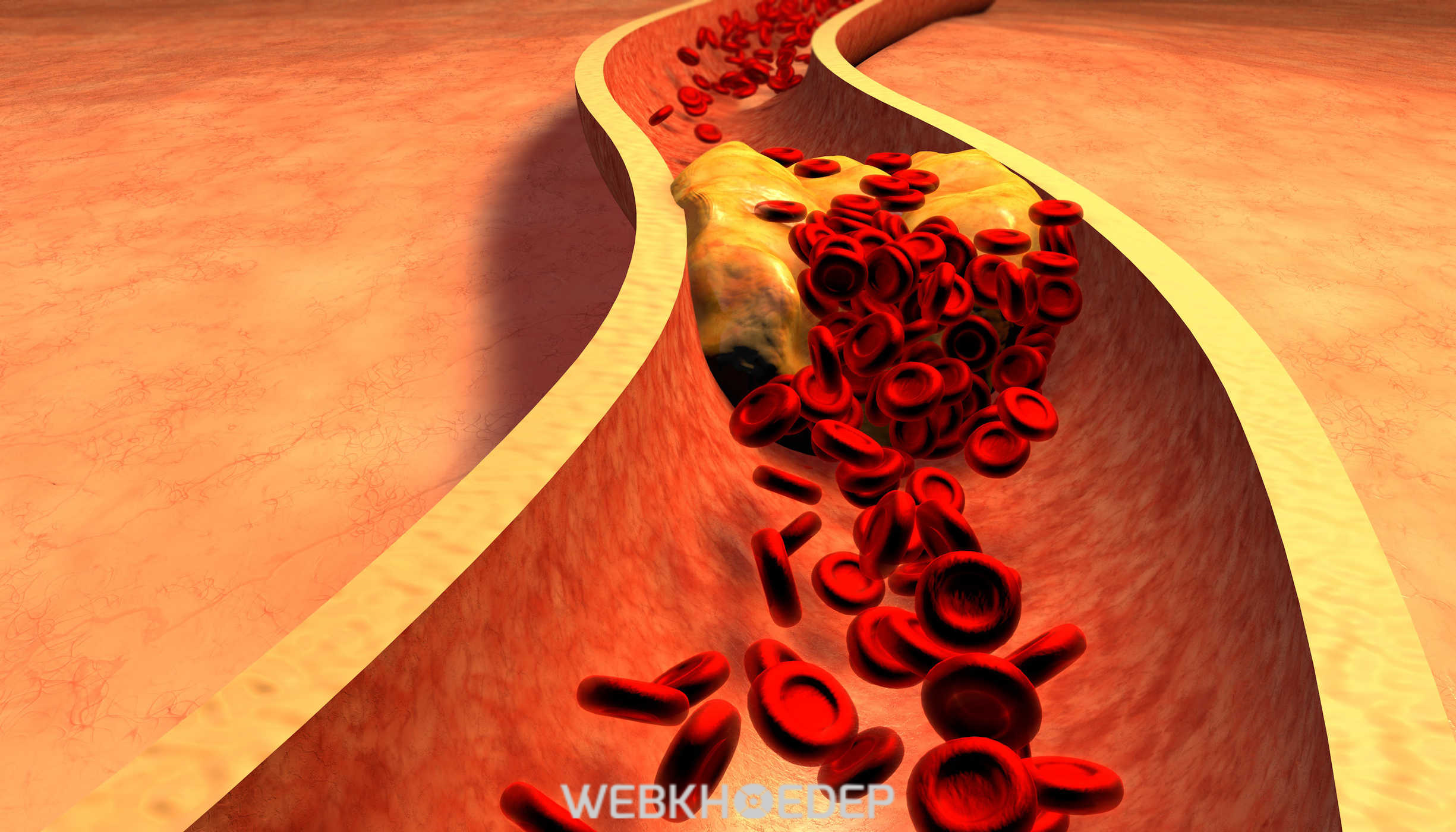 Omega 3 và DHA giúp giảm lượng Cholesterol trong máu