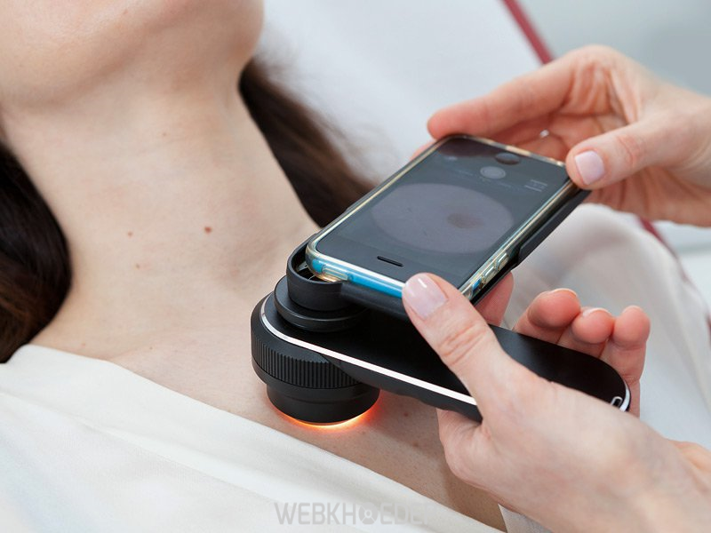 Các thiết bị y tế hiện đại có thể kiểm tra chính xác mức độ tổn thương của da