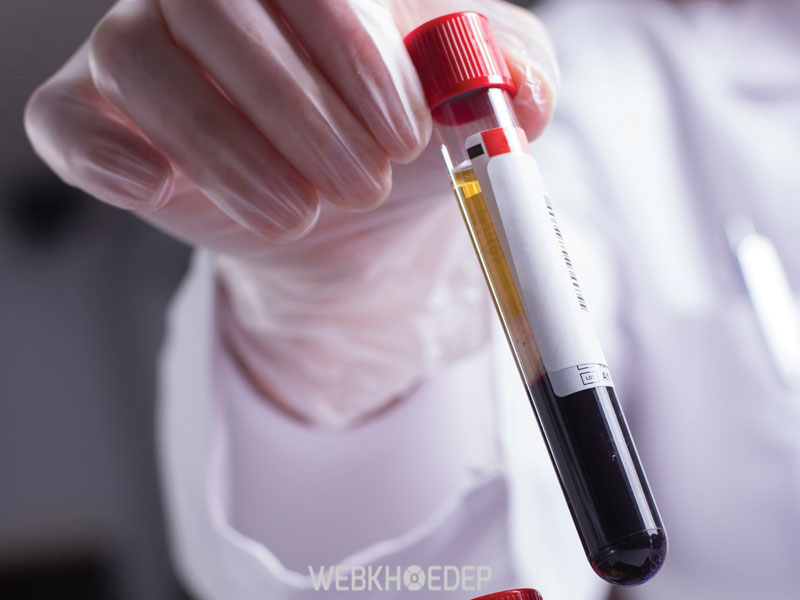 Cần xét nghiệm thường xuyên để kiểm tra ung thư máu