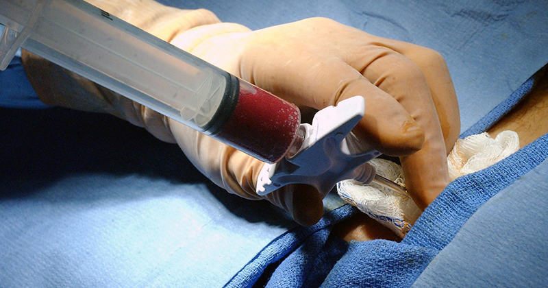 Ung thư máu giai đoạn đầu có chữa được không? Phác đồ điều trị bệnh